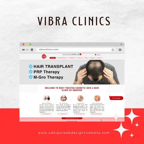 Hair Transplant Website Design Company